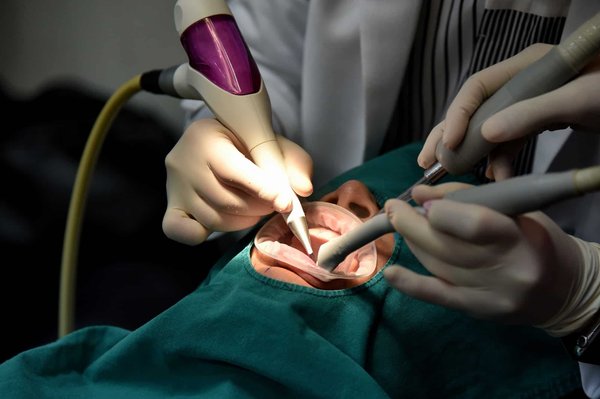 Soigner vos dents chez le meilleur dentiste